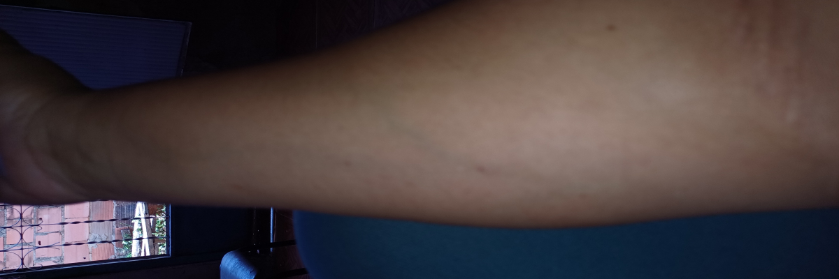 Abertura de Sindicancia e Fiscalização do Hospital Desembargador Leal Jr.